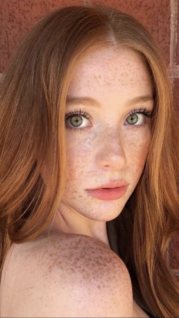 32 Hot Girls With Freckles 3