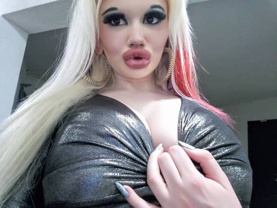 22-Year-Old Instagram Model Wants To Have The ‘Biggest Lips In The World,’ Already Had 15 Procedures To Achieve Her ‘Goal’ 148