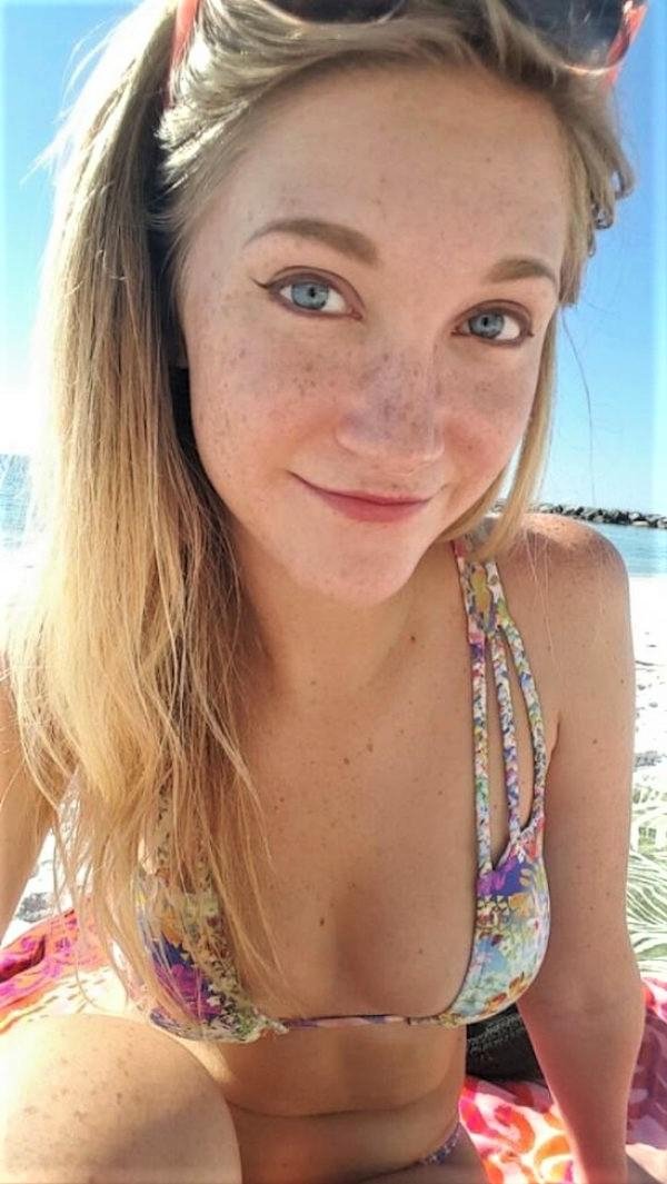 Girls with freckles really hit the… spot (37 Photos) 22