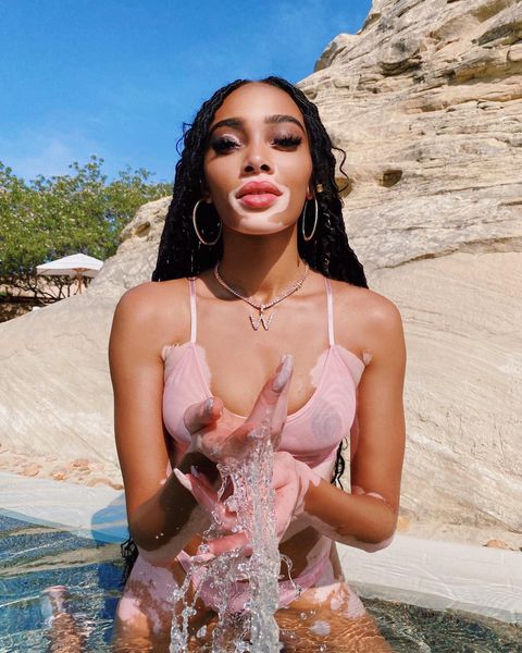 winnieharlow instagram photos 104