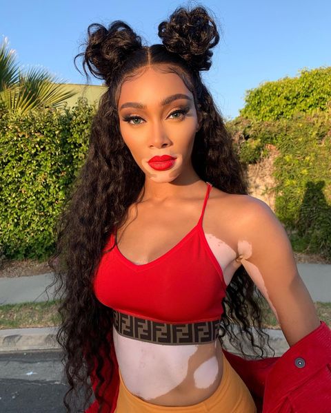 winnieharlow instagram photos 106