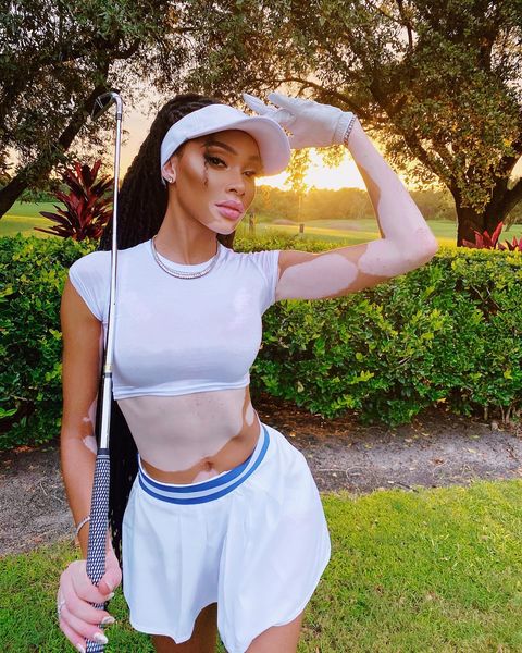 winnieharlow instagram photos 107