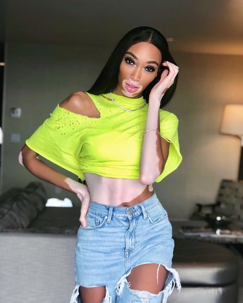 winnieharlow instagram photos 110