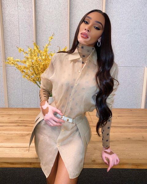 winnieharlow instagram photos 112