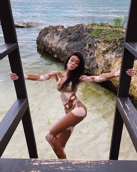 winnieharlow instagram photos 114