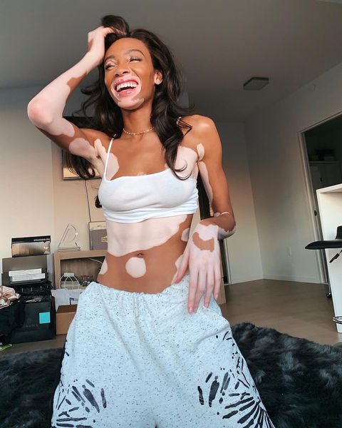 winnieharlow instagram photos 135