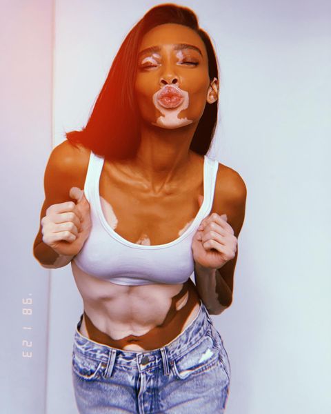 winnieharlow instagram photos 29