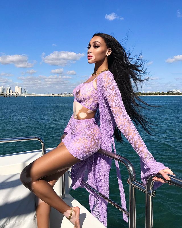 winnieharlow instagram photos 30