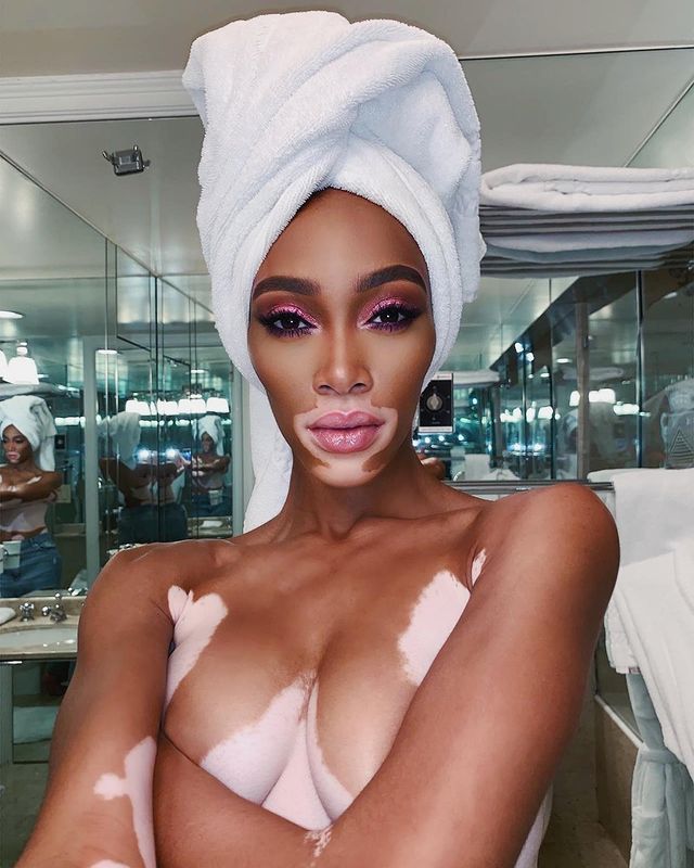 winnieharlow instagram photos 40