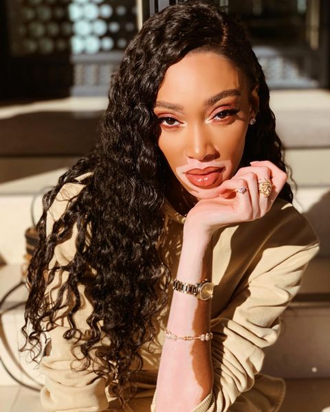 winnieharlow instagram photos 79